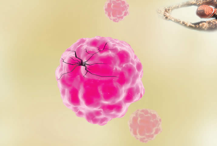 Conscientização sobre o câncer do colo de útero