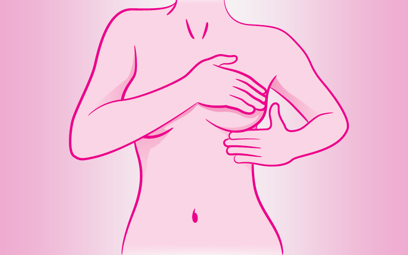 Câncer de mama se tornou a forma mais comum da doença no mundo, alerta OMS