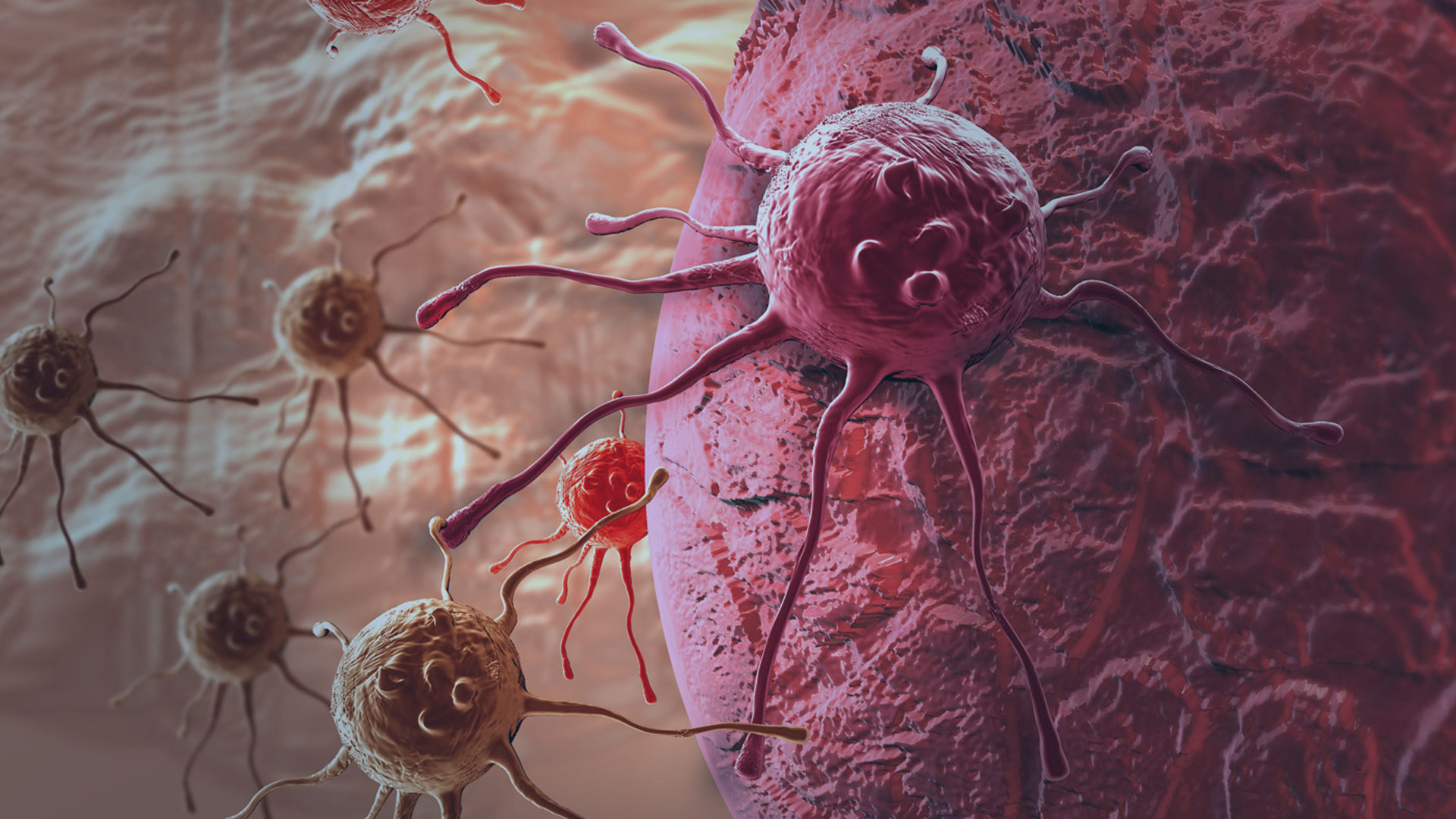 Com terapias modernas, câncer caminha para se tornar uma doença crônica controlável